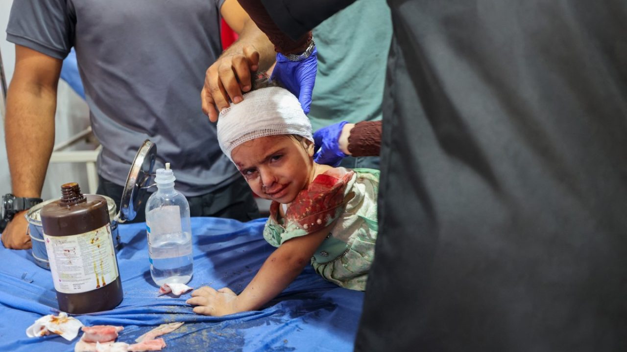 Palestinian casualties of an Israeli strike on an apartment at the Nuseirat refugee camp, receive care at Al-Awda hospital in the central Gaza Strip on July 19, 2025. (Photo by Eyad BABA / AFP)
