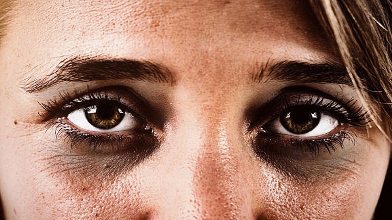 eyes