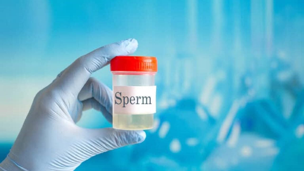 sperm